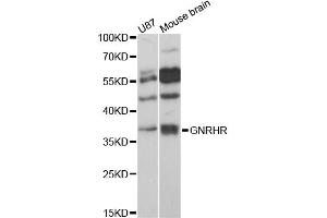 Western blot analysis of extracts of various cell lines, using GNRHR antibody (ABIN6292108) at 1:3000 dilution. (GNRHR 抗体)