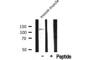 Western blot analysis on mouse muscle lysate using MAST2 Antibody (MAST2 抗体  (Internal Region))