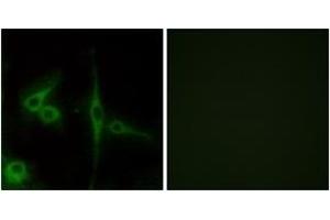 Immunofluorescence (IF) image for anti-EGF, Latrophilin and Seven Transmembrane Domain Containing 1 (ELTD1) (AA 251-300) antibody (ABIN1535603)