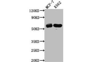 Western Blot Positive WB detected in: MCF-7 whole cell lysate, K562 whole cell lysate All lanes: HDAC2 antibody at 1:1000 Secondary Goat polyclonal to rabbit IgG at 1/50000 dilution Predicted band size: 56, 52 kDa Observed band size: 60 kDa (Recombinant HDAC2 抗体)