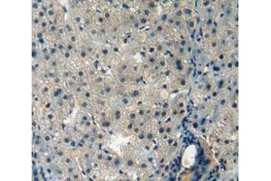 Used in DAB staining on fromalin fixed paraffin- embedded liver tissue (AMBP 抗体  (AA 22-203))