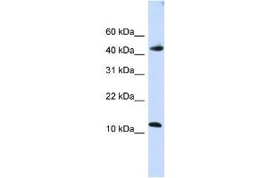 WB Suggested Anti-APOBEC3F Antibody Titration:  0.