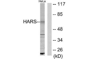 Western Blotting (WB) image for anti-Histidyl-tRNA Synthetase (HARS1) (C-Term) antibody (ABIN1849156) (HARS1/Jo-1 抗体  (C-Term))