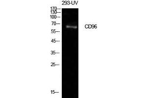 Western Blot (WB) analysis of 293-UV cells using CD96 Polyclonal Antibody.