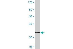 Western Blot detection against Immunogen (36. (NXF3 抗体  (AA 1-100))