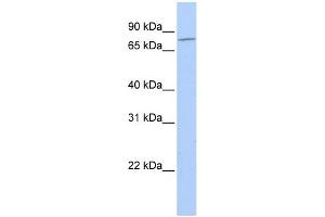 WB Suggested Anti-MZF1 Antibody Titration: 0. (MZF1 抗体  (N-Term))