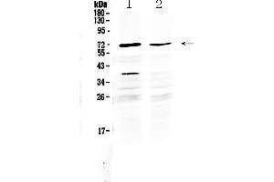 Western blot analysis of MAK using anti-MAK antibody .