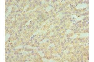 Immunohistochemistry of paraffin-embedded human kidney tissue using ABIN7142987 at dilution of 1:100 (ASAH1 抗体  (AA 146-395))