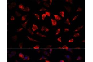 Immunofluorescence analysis of L929 cells using IGFBP4 Polyclonal Antibody at dilution of 1:100. (IGFBP4 抗体)