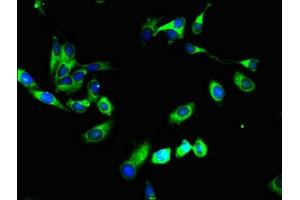 Immunofluorescent analysis of Hela cells using ABIN7151230 at dilution of 1:100 and Alexa Fluor 488-congugated AffiniPure Goat Anti-Rabbit IgG(H+L) (SYVN1 抗体  (AA 338-487))
