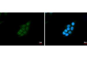Immunofluorescence (IF) image for anti-Small Nuclear Ribonucleoprotein D2 Polypeptide 16.5kDa (SNRPD2) antibody (ABIN2855196)