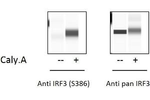 HT29 cells were treated or untreated with  Calyculin A and analyzed using this phosphoELISA and Western Blot. (IRF3 ELISA 试剂盒)