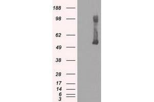 Image no. 2 for anti-Glucokinase (Hexokinase 4) (GCK) antibody (ABIN1498413) (GCK 抗体)