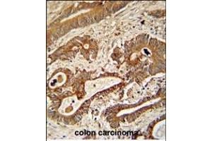 Immunohistochemistry (Paraffin-embedded Sections) (IHC (p)) image for anti-Ethylmalonic Encephalopathy 1 (ETHE1) (AA 103-130) antibody (ABIN390581)