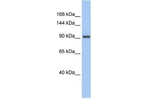 WB Suggested Anti-ZNF295 Antibody Titration:  0. (ZNF295 抗体  (N-Term))