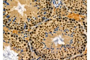 NUCL Antibody at 1/100 staining Mouse lung tissue by IHC-P. (Nucleolin 抗体  (Internal Region))