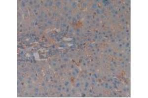 IHC-P analysis of Rat Liver Tissue, with DAB staining. (Complement Factor H 抗体  (AA 975-1217))