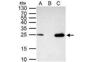 IP Image mtTFA antibody immunoprecipitates mtTFA protein in IP experiments. (TFAM 抗体)