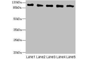 Western blot All lanes: COPB2 antibody at 2. (COPB2 抗体  (AA 657-906))