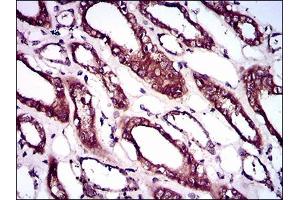 Immunohistochemical analysis of paraffin-embedded kidney tissues using BMPR1A mouse mAb with DAB staining. (BMPR1A 抗体  (AA 179-378))