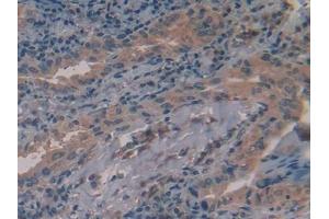 Immunohistochemistry (IHC) image for anti-Alanine Aminotransferase (ALT) (AA 147-263) antibody (ABIN7438472)