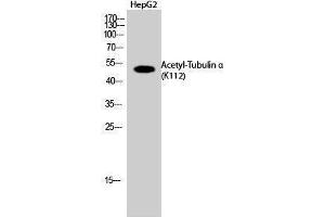 Western Blotting (WB) image for anti-alpha Tubulin (TUBA1) (acLys112) antibody (ABIN6285448) (alpha Tubulin 抗体  (acLys112))