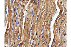 IHC analysis of NDUFS6 using anti-NDUFS6 antibody (ABIN7599568).