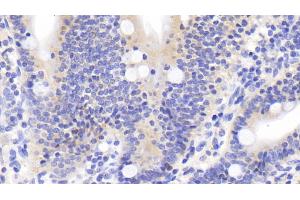 Detection of DTYMK in Human Small intestine Tissue using Polyclonal Antibody to Deoxythymidylate Kinase (DTYMK) (DTYMK 抗体  (AA 43-190))