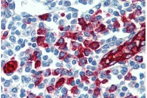 Human Tonsil: Formalin-Fixed, Paraffin-Embedded (FFPE) (SELPLG 抗体)