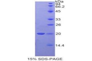 SDS-PAGE analysis of Human Tafazzin Protein. (TAZ 蛋白)