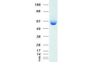 Western Blotting (WB) image for Aldehyde Dehydrogenase 1 Family, Member A1 (ALDH1A1) protein (Myc-DYKDDDDK Tag) (ABIN2714535)