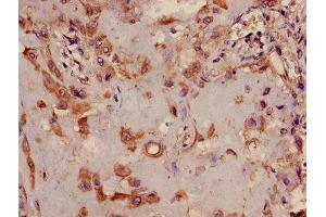 Immunohistochemistry of paraffin-embedded human placenta tissue using ABIN7173361 at dilution of 1:100 (TRIB2 抗体  (AA 204-337))