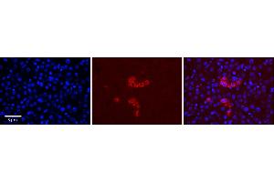 Rabbit Anti-RPS28 Antibody  Catalog Number: ARP65601_P050 Formalin Fixed Paraffin Embedded Tissue: Human Adult Liver  Observed Staining: Cytoplasm in Kupffer cells only, strong signal, very low tissue distribution Primary Antibody Concentration: 1:100 Secondary Antibody: Donkey anti-Rabbit-Cy3 Secondary Antibody Concentration: 1:200 Magnification: 20X Exposure Time: 0. (RPS28 抗体  (N-Term))