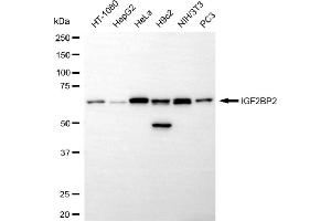 Western blotting analysis using IGF2BP2 antibody (ABIN7799051). (Recombinant IGF2BP2 抗体)