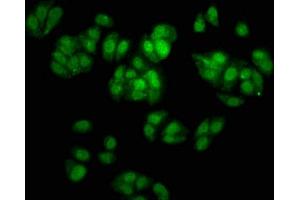 Immunofluorescence (IF) image for anti-SRY (Sex Determining Region Y)-Box 2 (SOX2) (AA 1-317) antibody (ABIN7172615)