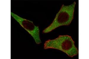 Immunofluorescence (IF) image for anti-Cyclin-Dependent Kinase 4 (CDK4) (AA 273-305) antibody (ABIN3030613)