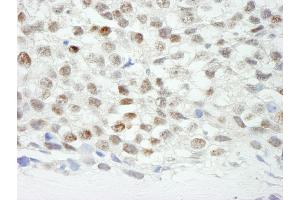 Immunohistochemistry (IHC) image for anti-Zinc Finger Protein 318 (Znf318) (AA 2049-2099) antibody (ABIN7449041) (ZNF318 抗体  (AA 2049-2099))
