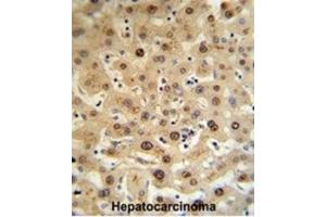 Immunohistochemistry (IHC) image for anti-Hemopexin (HPX) antibody (ABIN3002733) (Hemopexin 抗体)