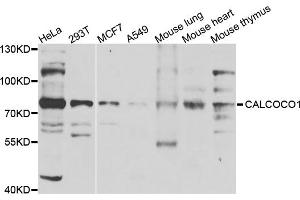 Western blot analysis of extracts of various cell lines, using CALCOCO1 antibody (ABIN5975736) at 1/1000 dilution. (CALCOCO1 抗体)