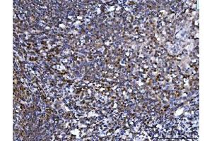 IHC analysis of SPT5/SUPT5H using anti-SPT5/SUPT5H antibody (ABIN7601985).