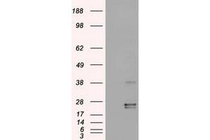HEK293T cells were transfected with the pCMV6-ENTRY control (Left lane) or pCMV6-ENTRY OSM (Right lane) cDNA for 48 hrs and lysed. (Oncostatin M 抗体  (AA 25-252))