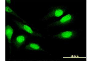 Immunofluorescence of monoclonal antibody to MNDA on HeLa cell. (MNDA 抗体  (AA 311-407))