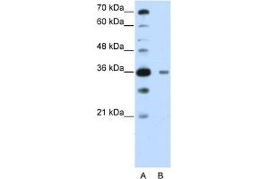 WB Suggested Anti-DAZAP1 Antibody Titration:  0. (DAZAP1 抗体  (C-Term))