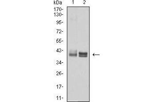 Western blot analysis using HLA-B mouse mAb against Ramos (1) and A431 (2) cell lysate. (HLA-B 抗体  (AA 241-362))