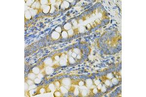 Immunohistochemistry of paraffin-embedded rat intestine using PGK1 Antibody. (PGK1 抗体  (AA 1-417))