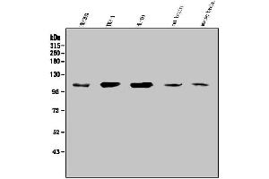 Western blot analysis of SEZ6L using anti-SEZ6L antibody (ABIN7602260). (SEZ6L 抗体  (AA 662-953))