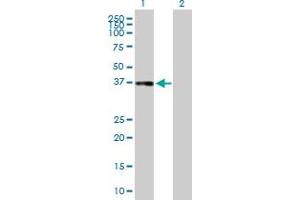 Western Blot analysis of CFHR1 expression in transfected 293T cell line by CFHR1 MaxPab polyclonal antibody. (CFHR1 抗体  (AA 19-330))