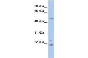 WB Suggested Anti-RBBP9 Antibody Titration:  0. (RBBP9 抗体  (N-Term))