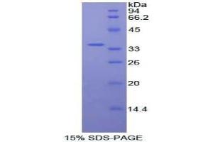 SDS-PAGE analysis of Human Protein Kinase B beta Protein. (AKT2 蛋白)