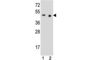 PAX9 antibody western blot analysis in (1) 293 and (2) Jurkat lysate (PAX9 抗体  (AA 69-95))